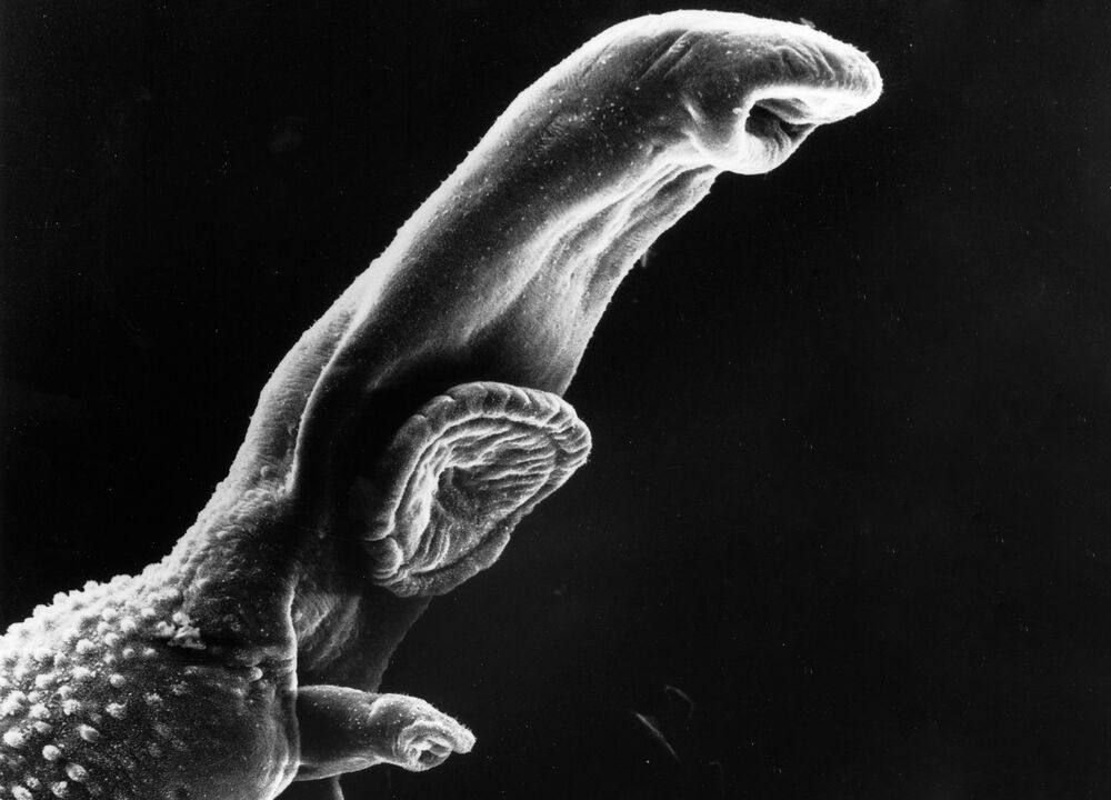 Шистосома – паразит, життєвий цикл якого потребує проміжного господаря