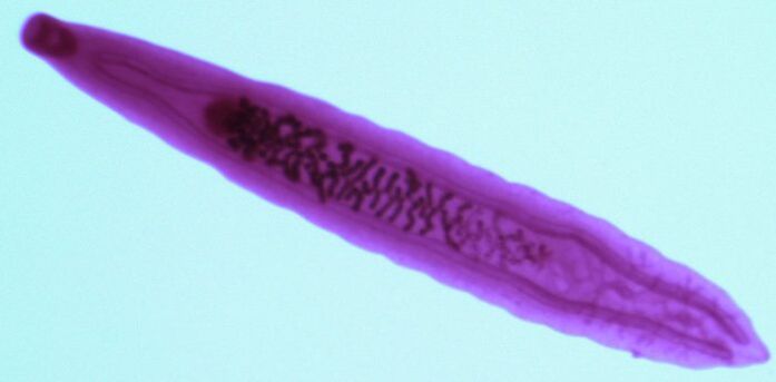 паразит двоустка з організму людини